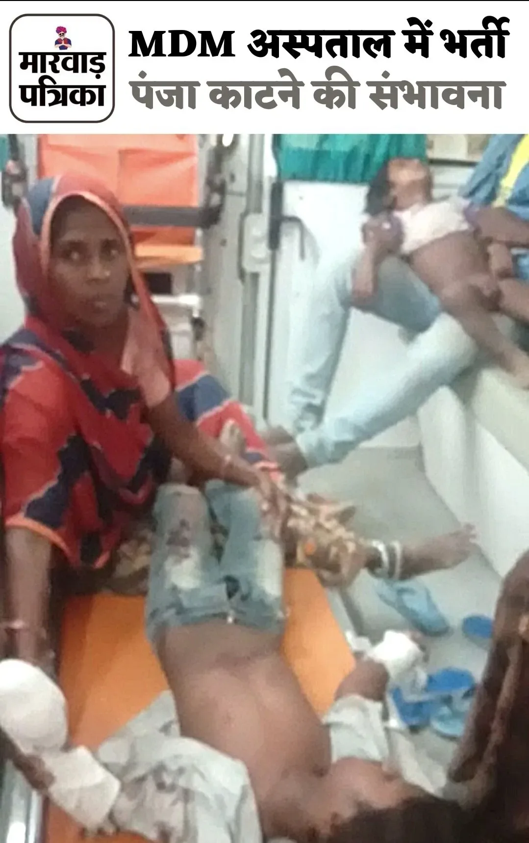 मोबाईल की बैटरी में विस्फोट, दो मासूम हुए घायल, एक का पंजा टूटा